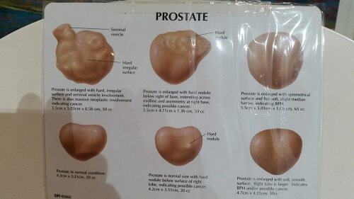 massage prostatique - soins sexualité